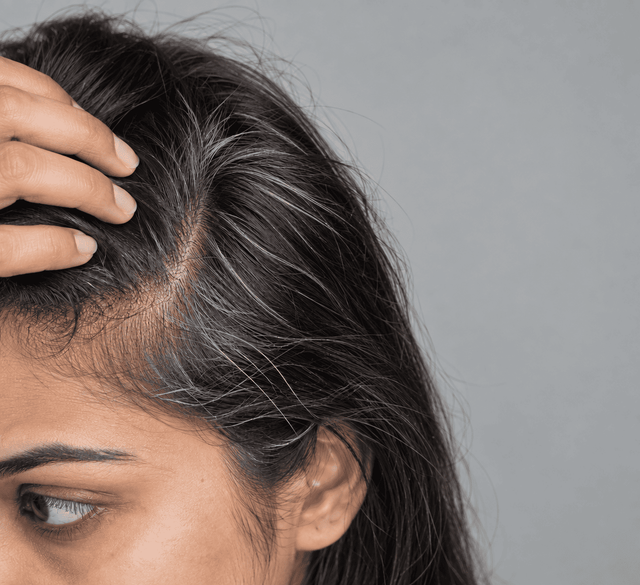 Visible Grey Strands