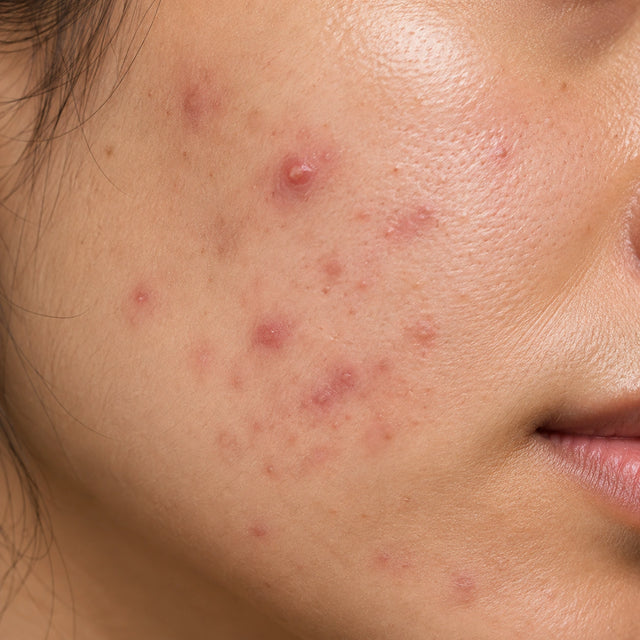 Active Breakouts